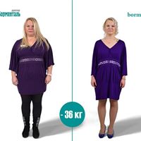 Похудение в Калининграде по методике "Доктор Борменталь"